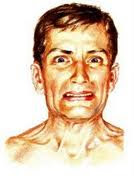 Facies sardónica