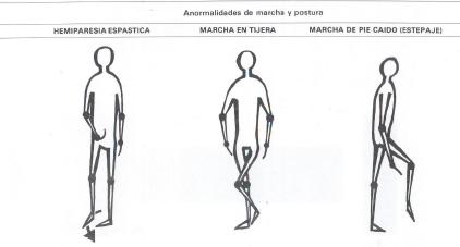 Esquema de marchas